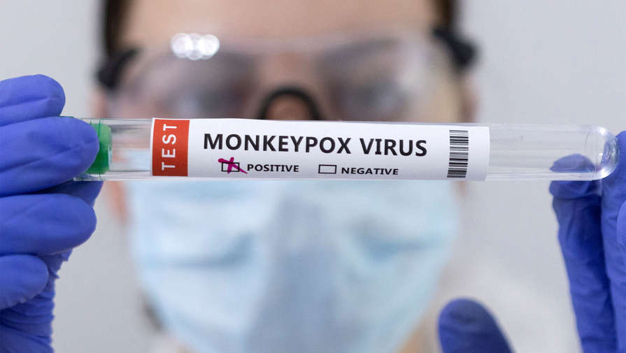 Вирусолог Альтштейн выступил против того, чтобы объявлять вспышку оспы обезьян пандемией