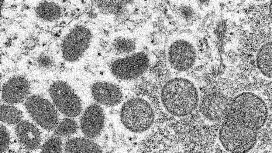 В США зафиксировали первую смерть заболевшего оспой обезьян